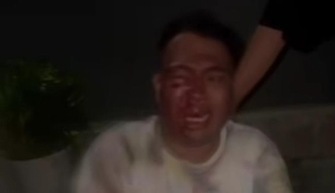 Tangkapan Layar, Oknum Polisi di Bitung Diduga Aniaya Warga