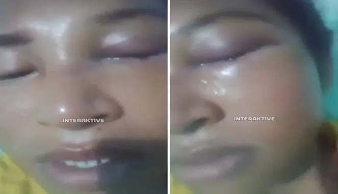 Kekerasan Brutal di Rokan Hulu: Suami Hancurkan Wajah Istri dengan Pukulan dan Injakan!