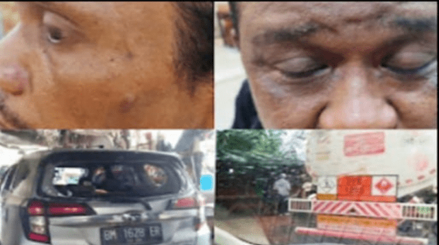 Hukum Tumpul! Mafia di Sijunjung Aniaya Wartawan, Polisi Bungkam?