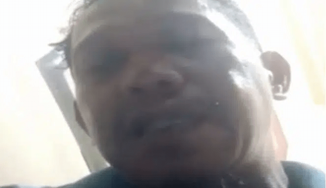 Lebam di Wajah MR Terekam VC Terakhir, Polisi Malah Sebut Efek Kamera