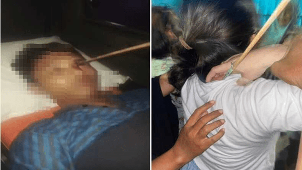Video Viral Warga Tallo Tertancap Busur Panah di Mata dan Leher
